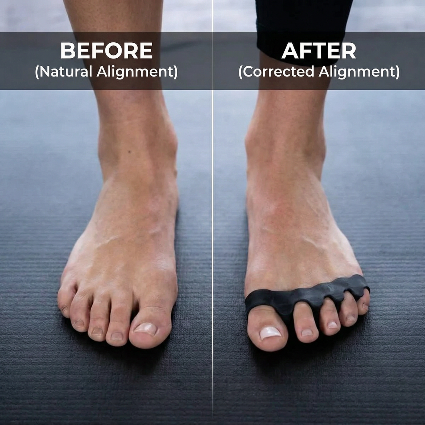 Vibit ALIGN Toe Spacers